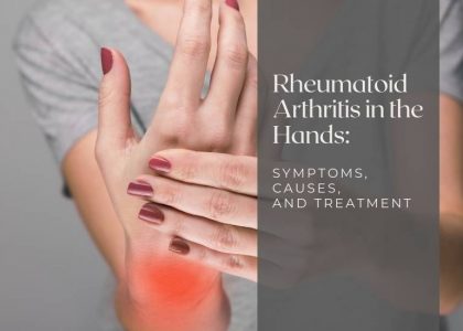 Rheumatoid Arthritis Symptoms in Hands