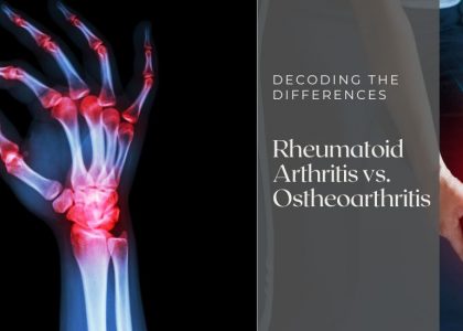 Rheumatoid Arthritis vs Ostheoarthritis